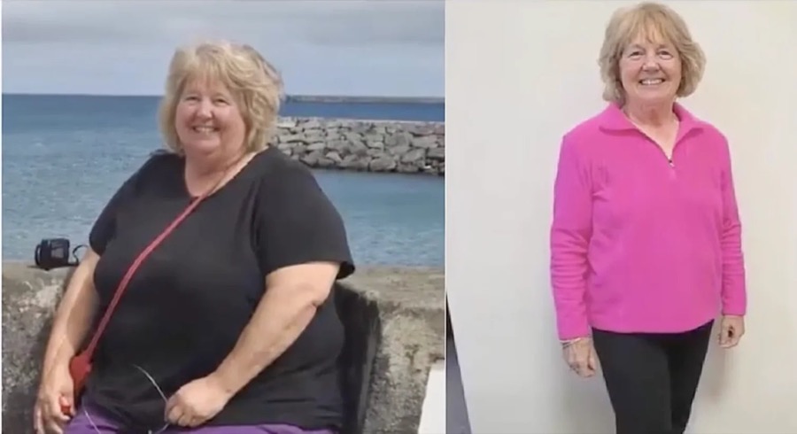 Before and after of Linda, 63, retired teacher