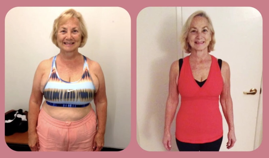 Before and after of Diane, 71, retired